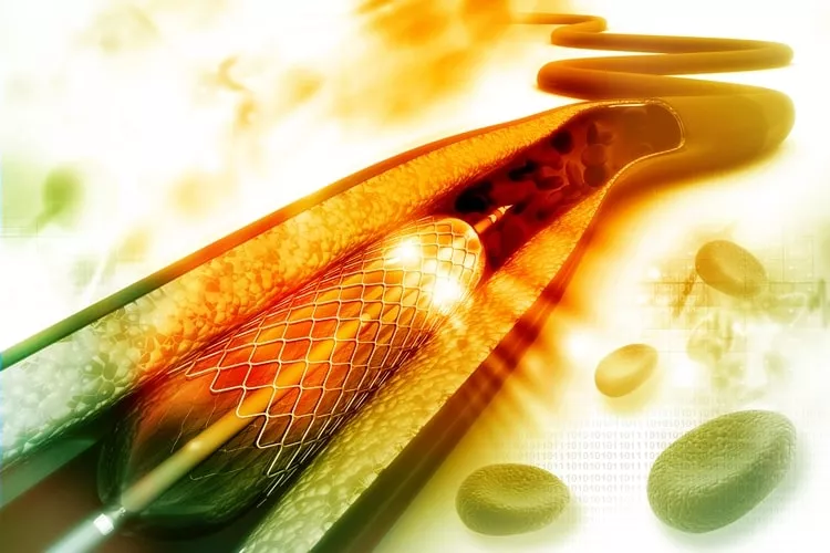 Ilustrační obrázek