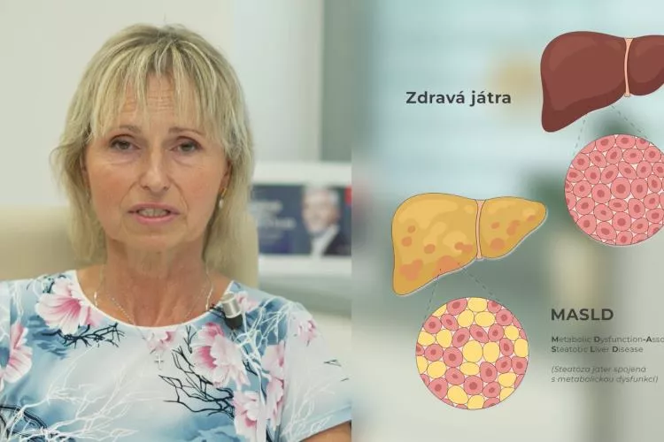 Ilustrační obrázek